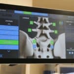 Spine Robotic Navigation System